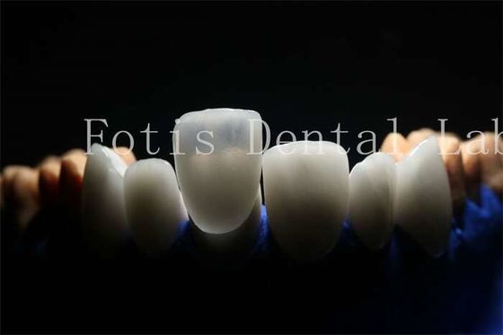 주문 포르셀라인 소재로 장수하고 내구성 있는 인공 라미네이트 포니어 online manufacture