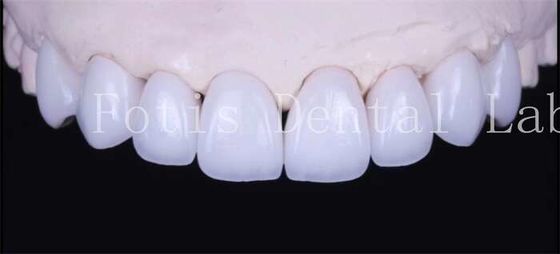 주문 접착성 결합 시멘트 천연 흰색 장단 고 투명성 online manufacture
