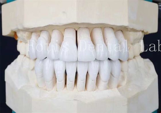 주문 접착성 결합 시멘트와 고강도 합성 라미네이트 장단 online manufacture
