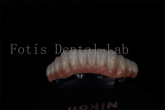 주문 전체 입 복원 모두 4에 그리고 모두 6에 티타늄 또는 지르코니아 높은 성공률 online manufacture