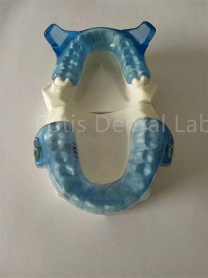 주문 고도 치아 정형 장치는 더 나은 치아 정렬 결과를 위해 online manufacture