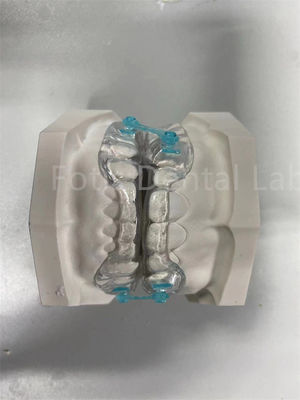 주문 프로페셔널 편안한 적합성 유지기 확장기 정형 치아 교정 장치 online manufacture