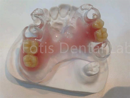 주문 소알레르기성 얼룩 저항성 TCS 밸플라스트 치아 인공 인형 online manufacture