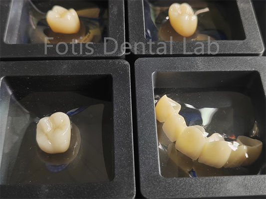주문 치아 복원 지르코니아 다층 골절 저항성 online manufacture