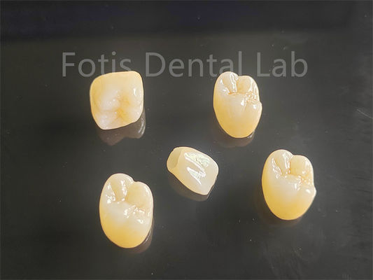 주문 미적 호소성 포스텔렌 전체 지층 지르코니아 왕관 다리 이상 online manufacture