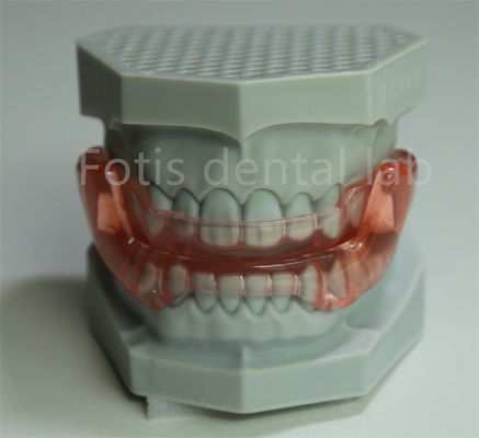 주문 OEM 정형 치아 유지기 확장기 모든 크기 대부분의 정형 치아 치료와 호환 online manufacture