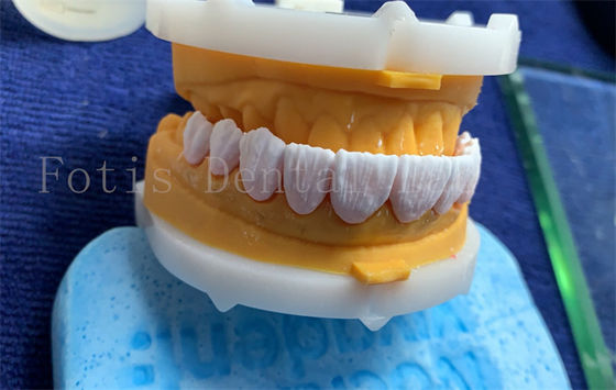 첨단 디지털 치과 왕관 임플란트 치과 왕관 FDA/ISO/CE 인증