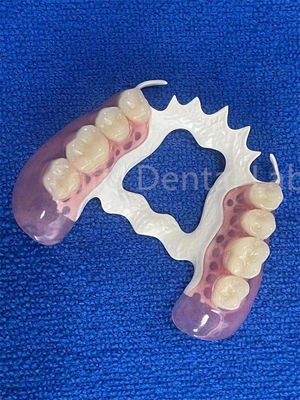 얼룩 에 저항 할 수 있는 제거 할 수 있는 치아 부분 안정적 인 빠진 치아 의 교체