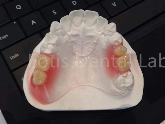 유연 한 TCS Valplast 치과 장비 편안 한 내구성 디자인