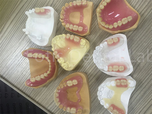 유연한 TCS Valplast 제거 가능한 부분 치아