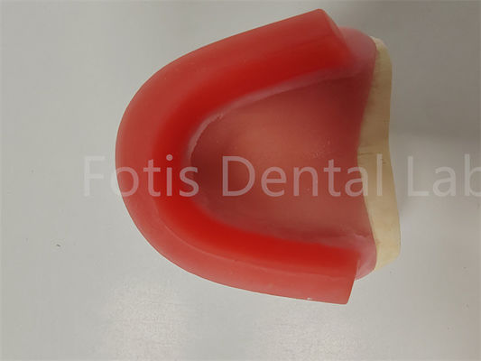 FDA 승인 물식 등록 Wax Rims Denture Occlusal Rim