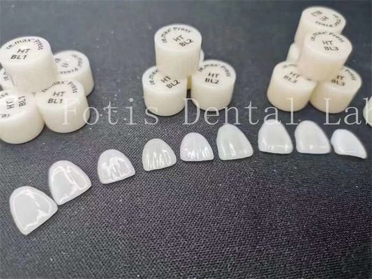 맞춤형 치과 실험실 laminate veneers 높은 얼룩 저항과 강도